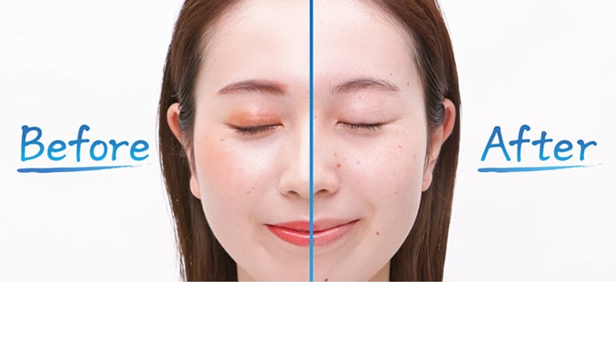 BeforeAfter