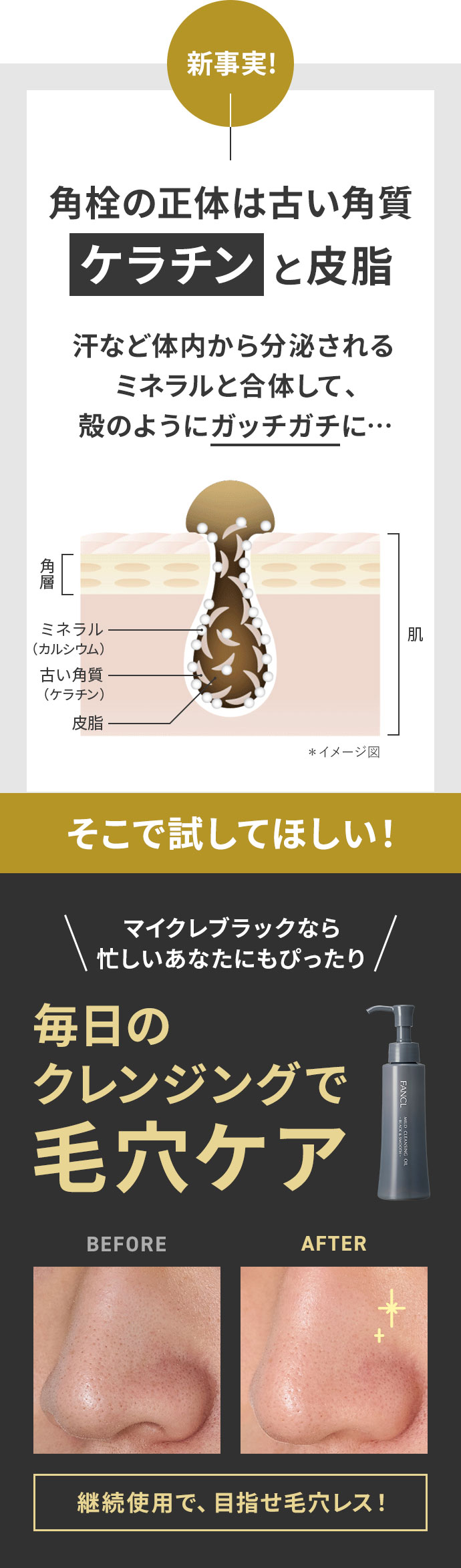 BeforeAfter