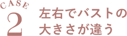 Case２ 左右でバストの大きさが違う